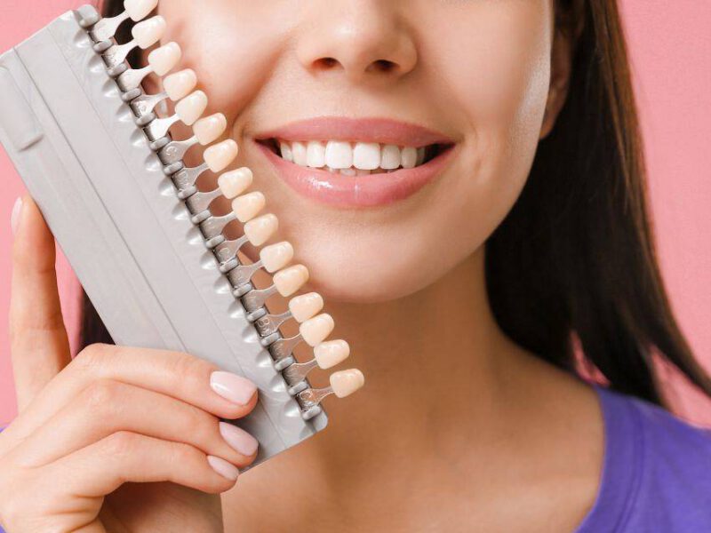 Woman is holding pallete of teeth colors getting ready to choose the coloro for her new veneers