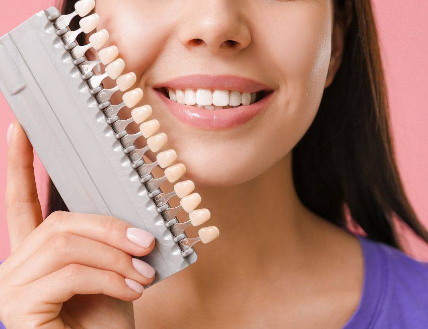 Woman is holding pallete of teeth colors getting ready to choose the coloro for her new veneers